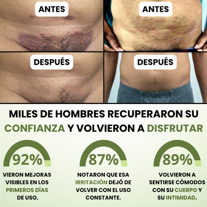 Bartilia® - Crema de Cuidado Para los Pliegues de la Piel