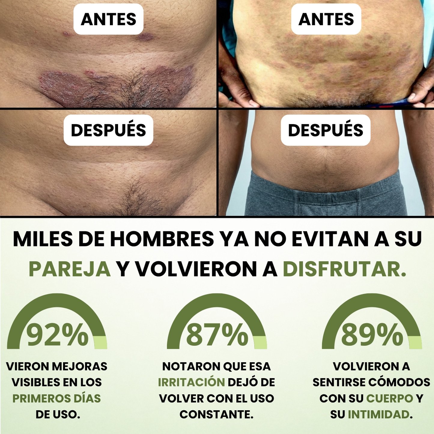 Bartilia® - Crema de Cuidado Para los Pliegues de la Piel